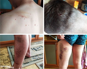 Тыдзень супраць катаванняў як ніколі актуальны для Беларусі 